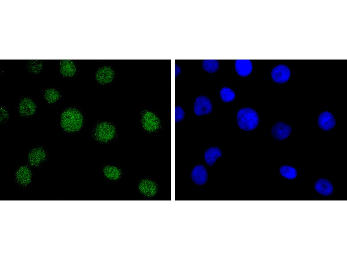 ICC staining of Bmi1 in A549 cells (green). Formalin fixed cells were permeabilized with 0.1% Triton X-100 in TBS for 10 minutes at room temperature and blocked with 1% Blocker BSA for 15 minutes at room temperature. Cells were probed with the primary antibody (ET1701-89, 1/50) for 1 hour at room temperature, washed with PBS. Alexa Fluor®488 Goat anti-Rabbit IgG was used as the secondary antibody at 1/1,000 dilution. The nuclear counter stain is DAPI (blue).