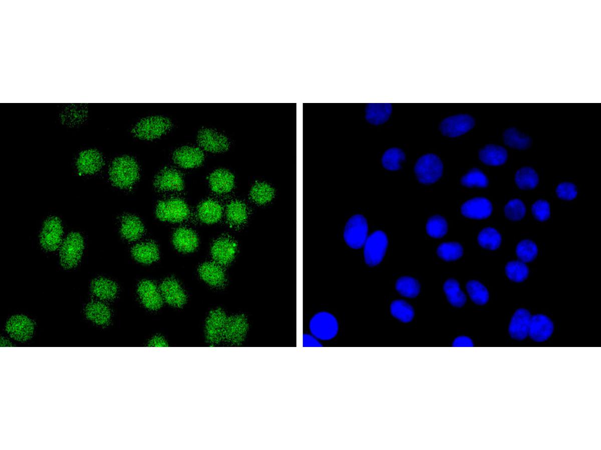 ICC staining of Bmi1 in SW480 cells (green). Formalin fixed cells were permeabilized with 0.1% Triton X-100 in TBS for 10 minutes at room temperature and blocked with 1% Blocker BSA for 15 minutes at room temperature. Cells were probed with the primary antibody (ET1701-89, 1/50) for 1 hour at room temperature, washed with PBS. Alexa Fluor®488 Goat anti-Rabbit IgG was used as the secondary antibody at 1/1,000 dilution. The nuclear counter stain is DAPI (blue).