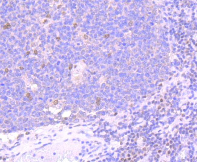 Immunohistochemical analysis of paraffin-embedded human tonsil tissue using anti-Bmi1 antibody. The section was pre-treated using heat mediated antigen retrieval with Tris-EDTA buffer (pH 8.0-8.4) for 20 minutes.The tissues were blocked in 5% BSA for 30 minutes at room temperature, washed with ddH2O and PBS, and then probed with the primary antibody (ET1701-89, 1/50) for 30 minutes at room temperature. The detection was performed using an HRP conjugated compact polymer system. DAB was used as the chromogen. Tissues were counterstained with hematoxylin and mounted with DPX.