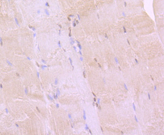 Immunohistochemical analysis of paraffin-embedded rat smooth muscle tissue using anti-Bmi1 antibody. The section was pre-treated using heat mediated antigen retrieval with Tris-EDTA buffer (pH 8.0-8.4) for 20 minutes.The tissues were blocked in 5% BSA for 30 minutes at room temperature, washed with ddH2O and PBS, and then probed with the primary antibody (ET1701-89, 1/50) for 30 minutes at room temperature. The detection was performed using an HRP conjugated compact polymer system. DAB was used as the chromogen. Tissues were counterstained with hematoxylin and mounted with DPX.