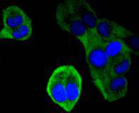 ICC staining of Ubiquitin D in Hela cells (green). Formalin fixed cells were permeabilized with 0.1% Triton X-100 in TBS for 10 minutes at room temperature and blocked with 1% Blocker BSA for 15 minutes at room temperature. Cells were probed with the primary antibody (ET1701-9, 1/50) for 1 hour at room temperature, washed with PBS. Alexa Fluor®488 Goat anti-Rabbit IgG was used as the secondary antibody at 1/1,000 dilution. The nuclear counter stain is DAPI (blue).