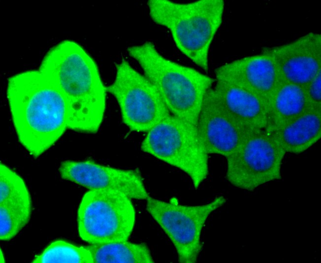 ICC staining of PTP1B in MCF-7 cells (green). Formalin fixed cells were permeabilized with 0.1% Triton X-100 in TBS for 10 minutes at room temperature and blocked with 1% Blocker BSA for 15 minutes at room temperature. Cells were probed with the primary antibody (ET1701-90, 1/50) for 1 hour at room temperature, washed with PBS. Alexa Fluor®488 Goat anti-Rabbit IgG was used as the secondary antibody at 1/1,000 dilution. The nuclear counter stain is DAPI (blue).
