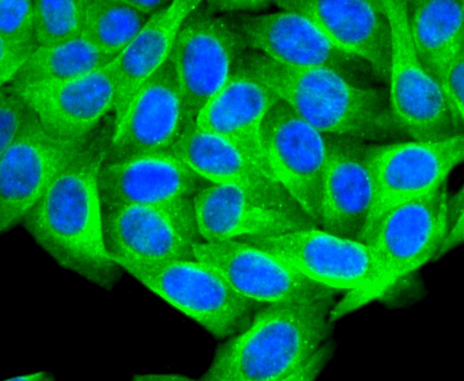 ICC staining of PTP1B in HepG2 cells (green). Formalin fixed cells were permeabilized with 0.1% Triton X-100 in TBS for 10 minutes at room temperature and blocked with 1% Blocker BSA for 15 minutes at room temperature. Cells were probed with the primary antibody (ET1701-90, 1/50) for 1 hour at room temperature, washed with PBS. Alexa Fluor®488 Goat anti-Rabbit IgG was used as the secondary antibody at 1/1,000 dilution. The nuclear counter stain is DAPI (blue).