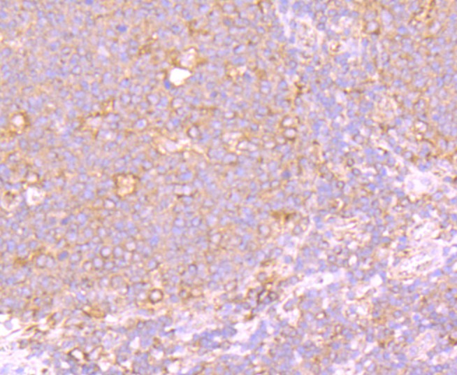 Immunohistochemical analysis of paraffin-embedded human tonsil tissue using anti-PTP1B antibody. The section was pre-treated using heat mediated antigen retrieval with Tris-EDTA buffer (pH 8.0-8.4) for 20 minutes.The tissues were blocked in 5% BSA for 30 minutes at room temperature, washed with ddH2O and PBS, and then probed with the primary antibody (ET1701-90, 1/50) for 30 minutes at room temperature. The detection was performed using an HRP conjugated compact polymer system. DAB was used as the chromogen. Tissues were counterstained with hematoxylin and mounted with DPX.