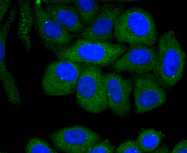 ICC staining of Fas(CD95) in HepG2 cells (green). Formalin fixed cells were permeabilized with 0.1% Triton X-100 in TBS for 10 minutes at room temperature and blocked with 1% Blocker BSA for 15 minutes at room temperature. Cells were probed with the primary antibody (ET1701-92, 1/100) for 1 hour at room temperature, washed with PBS. Alexa Fluor®488 Goat anti-Rabbit IgG was used as the secondary antibody at 1/100 dilution. The nuclear counter stain is DAPI (blue).