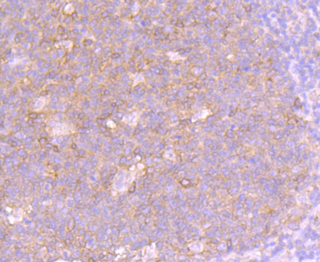 Immunohistochemical analysis of paraffin-embedded human tonsil tissue using anti-Fas(CD95) antibody. The section was pre-treated using heat mediated antigen retrieval with Tris-EDTA buffer (pH 8.0-8.4) for 20 minutes.The tissues were blocked in 5% BSA for 30 minutes at room temperature, washed with ddH2O and PBS, and then probed with the primary antibody (ET1701-92, 1/100) for 30 minutes at room temperature. The detection was performed using an HRP conjugated compact polymer system. DAB was used as the chromogen. Tissues were counterstained with hematoxylin and mounted with DPX.