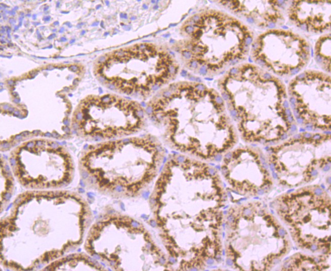 Immunohistochemical analysis of paraffin-embedded human kidney tissue using anti-LAMP1 antibody. The section was pre-treated using heat mediated antigen retrieval with Tris-EDTA buffer (pH 8.0-8.4) for 20 minutes.The tissues were blocked in 5% BSA for 30 minutes at room temperature, washed with ddH2O and PBS, and then probed with the primary antibody (ET1701-94, 1/50) for 30 minutes at room temperature. The detection was performed using an HRP conjugated compact polymer system. DAB was used as the chromogen. Tissues were counterstained with hematoxylin and mounted with DPX.