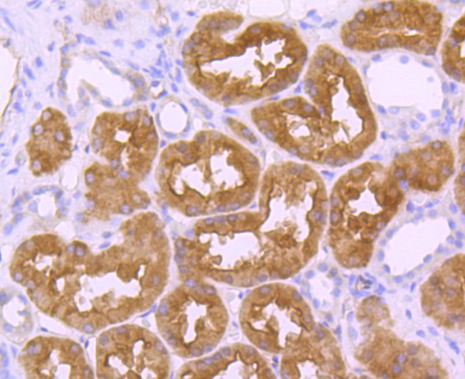 Immunohistochemical analysis of paraffin-embedded human kidney  tissue with Rabbit anti-EBP50 antibody (ET1701-96) at 1/50 dilution.<br />
<br />
The section was pre-treated using heat mediated antigen retrieval with sodium citrate buffer (pH 6.0) for 2 minutes. The tissues were blocked in 1% BSA for 20 minutes at room temperature, washed with ddH2O and PBS, and then probed with the primary antibody (ET1701-96) at 1/400 dilution for 1 hour at room temperature. The detection was performed using an HRP conjugated compact polymer system. DAB was used as the chromogen. Tissues were counterstained with hematoxylin and mounted with DPX.