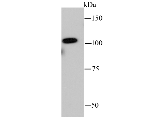 Western blot analysis of Insulin degrading enzyme on hybrid  fish (crucian-carp) heart tissue lysates. Proteins were transferred to a PVDF membrane and blocked with 5% BSA in PBS for 1 hour at room temperature. The primary antibody (ET1701-97, 1/500) was used in 5% BSA at room temperature for 2 hours. Goat Anti-Rabbit IgG - HRP Secondary Antibody (HA1001) at 1:200,000 dilution was used for 1 hour at room temperature.