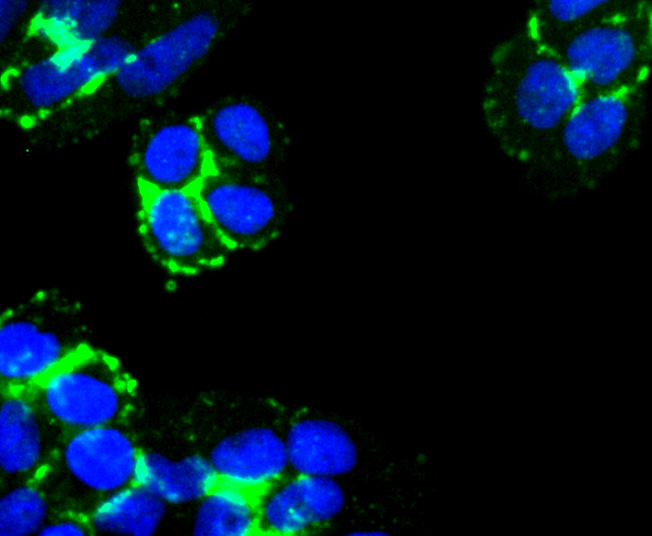 ICC staining of Laminnin 5 alpha 3 in Hela cells (green). Formalin fixed cells were permeabilized with 0.1% Triton X-100 in TBS for 10 minutes at room temperature and blocked with 1% Blocker BSA for 15 minutes at room temperature. Cells were probed with the primary antibody (ET1701-99, 1/50) for 1 hour at room temperature, washed with PBS. Alexa Fluor®488 Goat anti-Rabbit IgG was used as the secondary antibody at 1/1,000 dilution. The nuclear counter stain is DAPI (blue).
