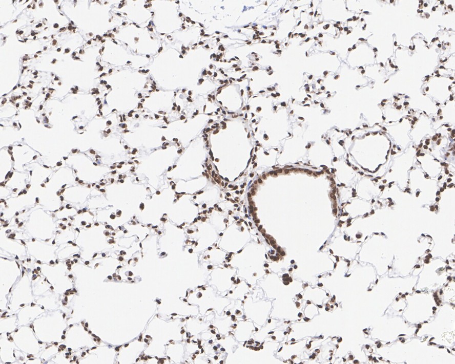 Immunohistochemical analysis of paraffin-embedded human kidney tissue using anti-SP1 antibody. The section was pre-treated using heat mediated antigen retrieval with Tris-EDTA buffer (pH 9.0) for 20 minutes.The tissues were blocked in 1% BSA for 30 minutes at room temperature, washed with ddH2O and PBS, and then probed with the primary antibody (ET1702-02, 1/50) for 30 minutes at room temperature. The detection was performed using an HRP conjugated compact polymer system. DAB was used as the chromogen. Tissues were counterstained with hematoxylin and mounted with DPX.
