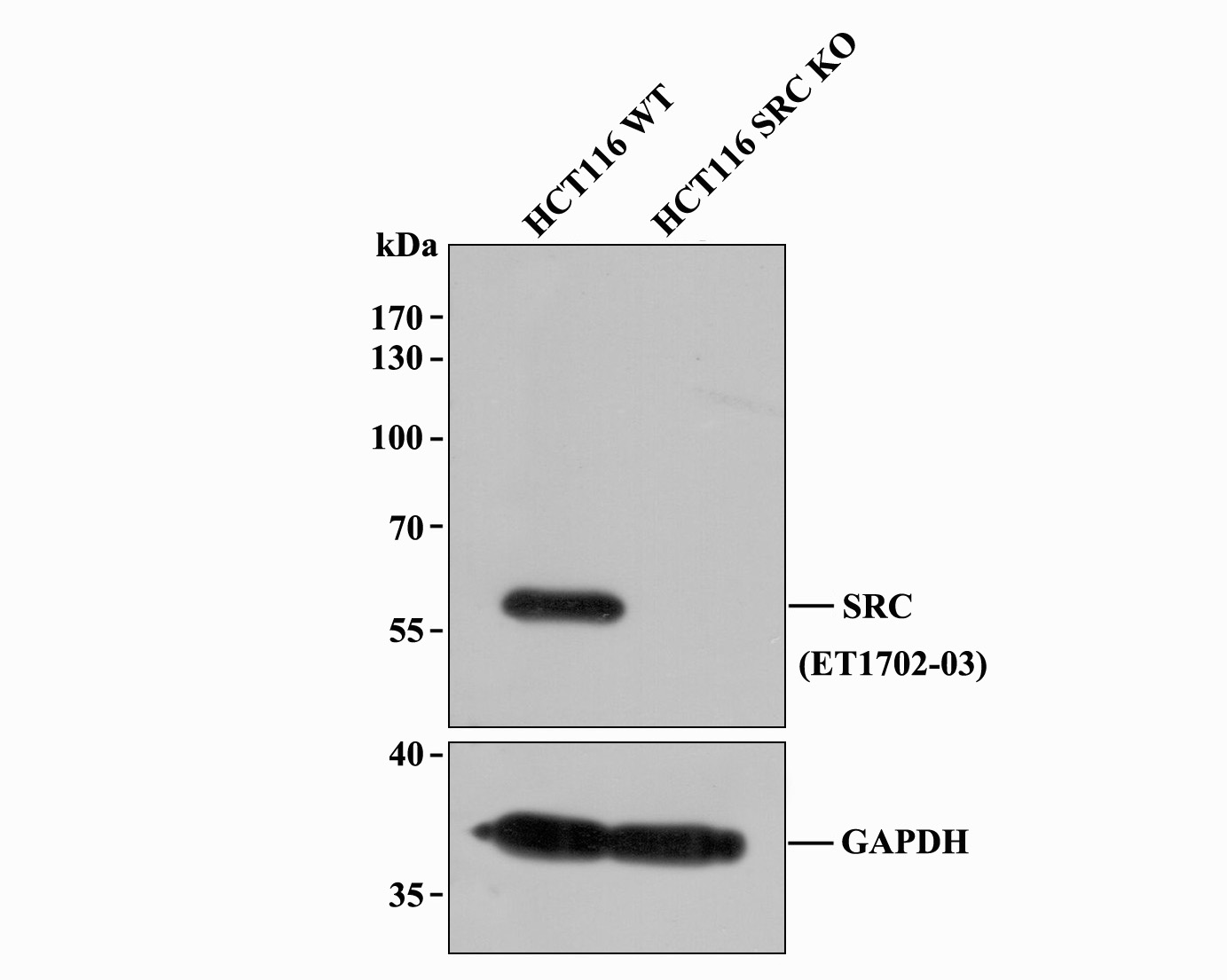 All lanes: Western blot analysis of Src with anti-Src antibody [JF0947] (ET1702-03) at 1:1,000 dilution.<br />
Lane 1: Wild-type HCT116 whole cell lysate (20 µg).<br />
Lane 2: Src knockout HCT116 whole cell lysate (20 µg).<br />
<br />
ET1702-03 was shown to specifically react with Src in wild-type HCT116 cells. No band was observed when Src knockout sample was tested. Wild-type and Src knockout samples were subjected to SDS-PAGE. Proteins were transferred to a PVDF membrane and blocked with 5% NFDM in TBST for 1 hour at room temperature. The primary antibody (ET1702-03, 1/1,000) and Loading control antibody (Rabbit anti-GAPDH , ET1601-4, 1/10,000) was used in 5% BSA at room temperature for 2 hours. Goat Anti-Rabbit IgG-HRP Secondary Antibody (HA1001) at 1:200,000 dilution was used for 1 hour at room temperature.