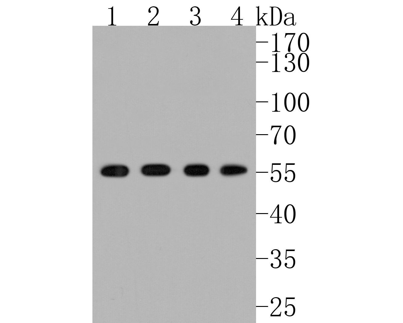 Western blot analysis of Src on different lysates. Proteins were transferred to a PVDF membrane and blocked with 5% BSA in PBS for 1 hour at room temperature. The primary antibody (ET1702-03, 1/500) was used in 5% BSA at room temperature for 2 hours. Goat Anti-Rabbit IgG - HRP Secondary Antibody (HA1001) at 1:5,000 dilution was used for 1 hour at room temperature.<br />
Positive control: <br />
Lane 1: HUVEC cell lysate<br />
Lane 2: A549 cell lysate<br />
Lane 3: PC-3M cell lysate<br />
Lane 4: SH-SY5Y cell lysate