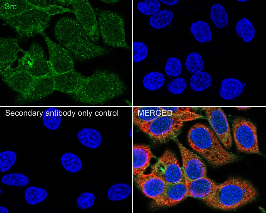 ICC staining of Src in Hela cells (green). Formalin fixed cells were permeabilized with 0.1% Triton X-100 in TBS for 10 minutes at room temperature and blocked with 1% Blocker BSA for 15 minutes at room temperature. Cells were probed with the primary antibody (ET1702-03, 1/50) for 1 hour at room temperature, washed with PBS. Alexa Fluor®488 Goat anti-Rabbit IgG was used as the secondary antibody at 1/1,000 dilution. The nuclear counter stain is DAPI (blue).
