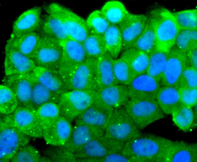 ICC staining of Src in MCF-7 cells (green). Formalin fixed cells were permeabilized with 0.1% Triton X-100 in TBS for 10 minutes at room temperature and blocked with 1% Blocker BSA for 15 minutes at room temperature. Cells were probed with the primary antibody (ET1702-03, 1/50) for 1 hour at room temperature, washed with PBS. Alexa Fluor®488 Goat anti-Rabbit IgG was used as the secondary antibody at 1/1,000 dilution. The nuclear counter stain is DAPI (blue).