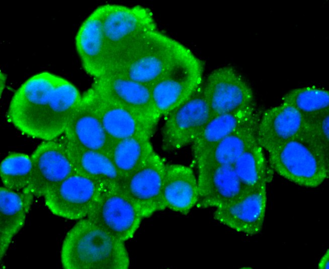 ICC staining of Src in A431 cells (green). Formalin fixed cells were permeabilized with 0.1% Triton X-100 in TBS for 10 minutes at room temperature and blocked with 1% Blocker BSA for 15 minutes at room temperature. Cells were probed with the primary antibody (ET1702-03, 1/50) for 1 hour at room temperature, washed with PBS. Alexa Fluor®488 Goat anti-Rabbit IgG was used as the secondary antibody at 1/1,000 dilution. The nuclear counter stain is DAPI (blue).