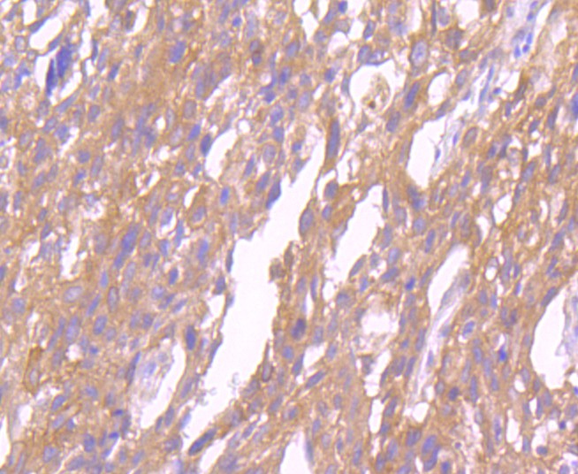Immunohistochemical analysis of paraffin-embedded human kidney tissue using anti-Src antibody. The section was pre-treated using heat mediated antigen retrieval with Tris-EDTA buffer (pH 8.0-8.4) for 20 minutes.The tissues were blocked in 5% BSA for 30 minutes at room temperature, washed with ddH2O and PBS, and then probed with the primary antibody (ET1702-03, 1/50) for 30 minutes at room temperature. The detection was performed using an HRP conjugated compact polymer system. DAB was used as the chromogen. Tissues were counterstained with hematoxylin and mounted with DPX.