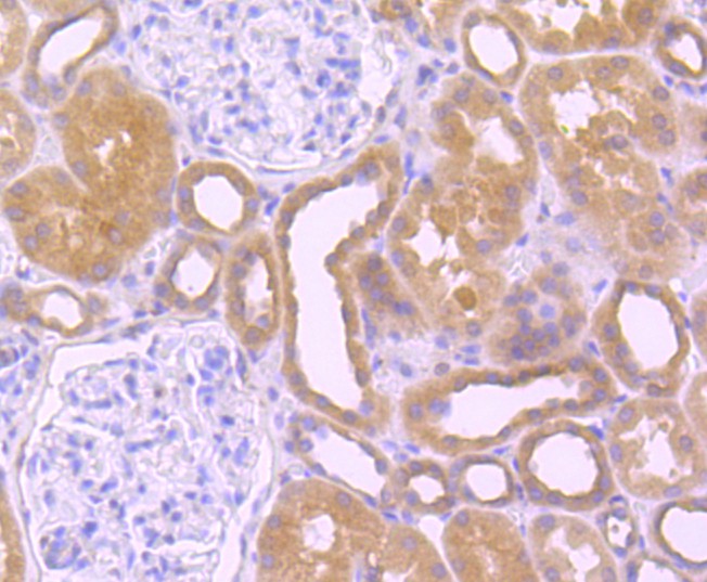 Immunohistochemical analysis of paraffin-embedded rat brain tissue using anti-Src antibody. The section was pre-treated using heat mediated antigen retrieval with Tris-EDTA buffer (pH 8.0-8.4) for 20 minutes.The tissues were blocked in 5% BSA for 30 minutes at room temperature, washed with ddH2O and PBS, and then probed with the primary antibody (ET1702-03, 1/50) for 30 minutes at room temperature. The detection was performed using an HRP conjugated compact polymer system. DAB was used as the chromogen. Tissues were counterstained with hematoxylin and mounted with DPX.