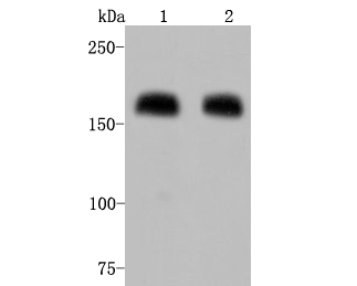 Western blot analysis of Mannose Receptor(CD206) on different lysates. Proteins were transferred to a PVDF membrane and blocked with 5% BSA in PBS for 1 hour at room temperature. The primary antibody (ET1702-04, 1/500) was used in 5% BSA at room temperature for 2 hours. Goat Anti-Rabbit IgG - HRP Secondary Antibody (HA1001) at 1:5,000 dilution was used for 1 hour at room temperature.<br />
Positive control: <br />
Lane 1: Human lung tissue lysate<br />
Lane 2: HepG2 cell lysate