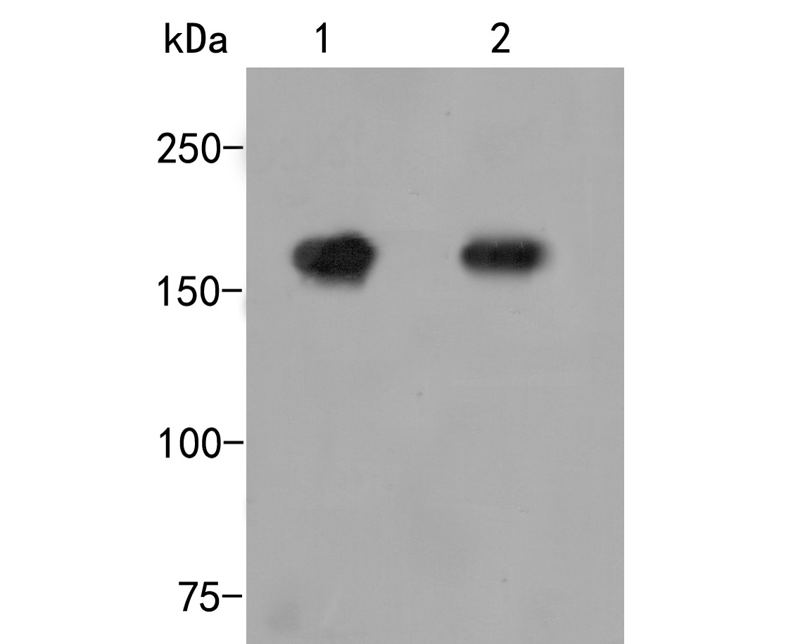 Western blot analysis of Mannose Receptor(CD206) on different lysates. Proteins were transferred to a PVDF membrane and blocked with 5% BSA in PBS for 1 hour at room temperature. The primary antibody (ET1702-04, 1/500) was used in 5% BSA at room temperature for 2 hours. Goat Anti-Rabbit IgG - HRP Secondary Antibody (HA1001) at 1:5,000 dilution was used for 1 hour at room temperature.<br />
Positive control: <br />
Lane 1: Mouse lung tissue lysate<br />
Lane 2: D3 cell lysate
