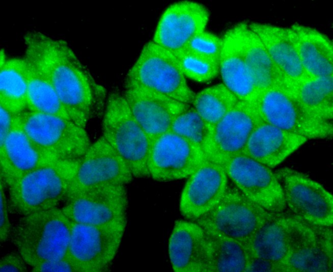 ICC staining of 67kDa Laminin Receptor in Hela cells (green). Formalin fixed cells were permeabilized with 0.1% Triton X-100 in TBS for 10 minutes at room temperature and blocked with 10% negative goat serum for 15 minutes at room temperature. Cells were probed with the primary antibody (ET1702-05, 1/50) for 1 hour at room temperature, washed with PBS. Alexa Fluor®488 conjugate-Goat anti-Rabbit IgG was used as the secondary antibody at 1/1,000 dilution. The nuclear counter stain is DAPI (blue).