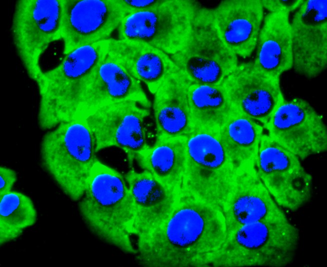 ICC staining of 67kDa Laminin Receptor in RH-35 cells (green). Formalin fixed cells were permeabilized with 0.1% Triton X-100 in TBS for 10 minutes at room temperature and blocked with 10% negative goat serum for 15 minutes at room temperature. Cells were probed with the primary antibody (ET1702-05, 1/50) for 1 hour at room temperature, washed with PBS. Alexa Fluor®488 conjugate-Goat anti-Rabbit IgG was used as the secondary antibody at 1/1,000 dilution. The nuclear counter stain is DAPI (blue).