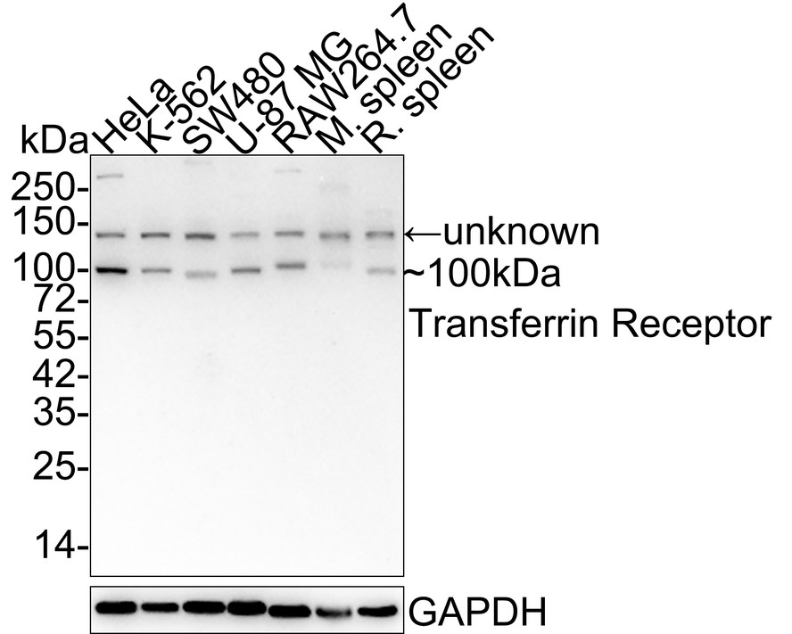 Western blot analysis of Transferrin Receptor (CD71) on mouse placenta tissue lysates. Proteins were transferred to a PVDF membrane and blocked with 5% BSA in PBS for 1 hour at room temperature. The primary antibody (ET1702-06, 1/500) was used in 5% BSA at room temperature for 2 hours. Goat Anti-Rabbit IgG - HRP Secondary Antibody (HA1001) at 1:5,000 dilution was used for 1 hour at room temperature.