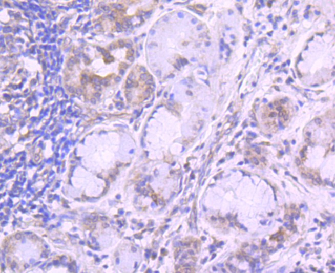 Immunohistochemical analysis of paraffin-embedded mouse brain tissue using anti-Transferrin Receptor (CD71) antibody. The section was pre-treated using heat mediated antigen retrieval with Tris-EDTA buffer (pH 8.0-8.4) for 20 minutes.The tissues were blocked in 5% BSA for 30 minutes at room temperature, washed with ddH2O and PBS, and then probed with the primary antibody (ET1702-06, 1/50) for 30 minutes at room temperature. The detection was performed using an HRP conjugated compact polymer system. DAB was used as the chromogen. Tissues were counterstained with hematoxylin and mounted with DPX.