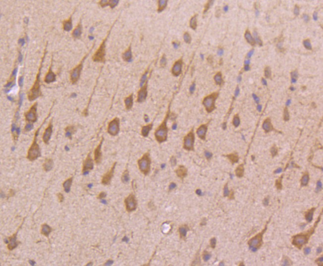 Immunohistochemical analysis of paraffin-embedded mouse placenta tissue using anti-Transferrin Receptor (CD71) antibody. The section was pre-treated using heat mediated antigen retrieval with Tris-EDTA buffer (pH 8.0-8.4) for 20 minutes.The tissues were blocked in 5% BSA for 30 minutes at room temperature, washed with ddH2O and PBS, and then probed with the primary antibody (ET1702-06, 1/50) for 30 minutes at room temperature. The detection was performed using an HRP conjugated compact polymer system. DAB was used as the chromogen. Tissues were counterstained with hematoxylin and mounted with DPX.