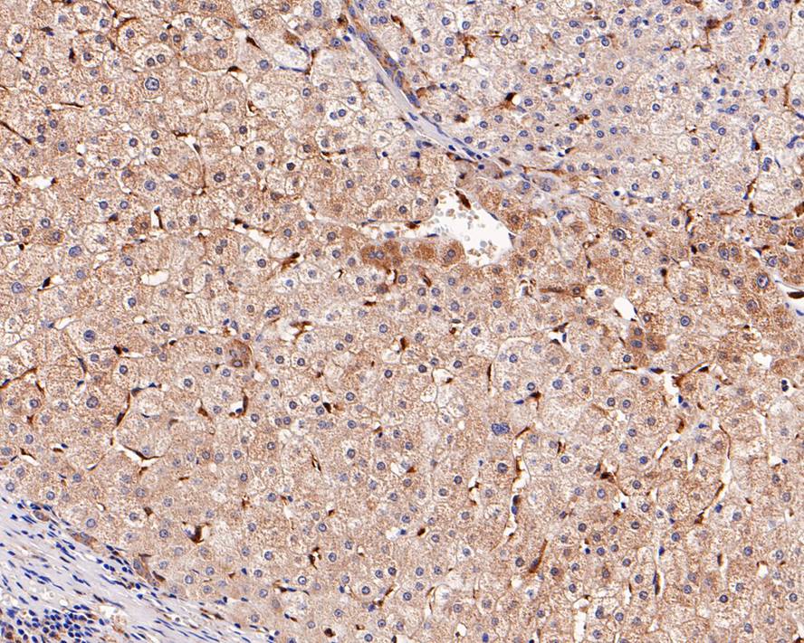 Immunohistochemical analysis of paraffin-embedded human liver tissue with Rabbit anti-Glutathione Peroxidase 1 antibody (ET1702-09) at 1/1,000 dilution.<br />
<br />
The section was pre-treated using heat mediated antigen retrieval with Tris-EDTA buffer (pH 9.0) for 20 minutes. The tissues were blocked in 1% BSA for 20 minutes at room temperature, washed with ddH2O and PBS, and then probed with the primary antibody (ET1702-09) at 1/1,000 dilution for 1 hour at room temperature. The detection was performed using an HRP conjugated compact polymer system. DAB was used as the chromogen. Tissues were counterstained with hematoxylin and mounted with DPX.