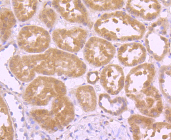 Immunohistochemical analysis of paraffin-embedded human kidney tissue using anti-Glutathione Peroxidase 1 antibody. Counter stained with hematoxylin.