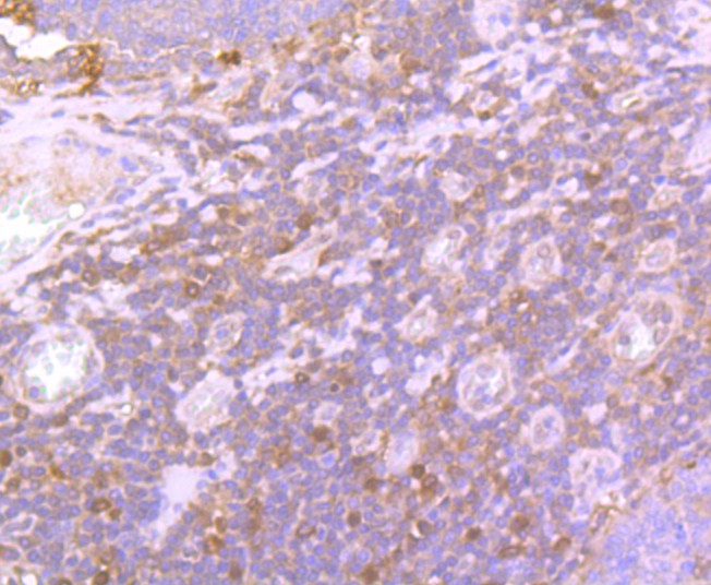 Immunohistochemical analysis of paraffin-embedded human tonsil tissue using anti-Glutathione Peroxidase 1 antibody. Counter stained with hematoxylin.