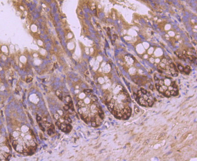 Immunohistochemical analysis of paraffin-embedded  mouse colon tissue with Rabbit anti-VAMP8 antibody (ET1702-10) at 1/50 dilution.<br />
<br />
The section was pre-treated using heat mediated antigen retrieval with Tris-EDTA buffer (pH 9.0) for 20 minutes. The tissues were blocked in 1% BSA for 20 minutes at room temperature, washed with ddH2O and PBS, and then probed with the primary antibody (ET1702-10) at 1/400 dilution for 1 hour at room temperature. The detection was performed using an HRP conjugated compact polymer system. DAB was used as the chromogen. Tissues were counterstained with hematoxylin and mounted with DPX.