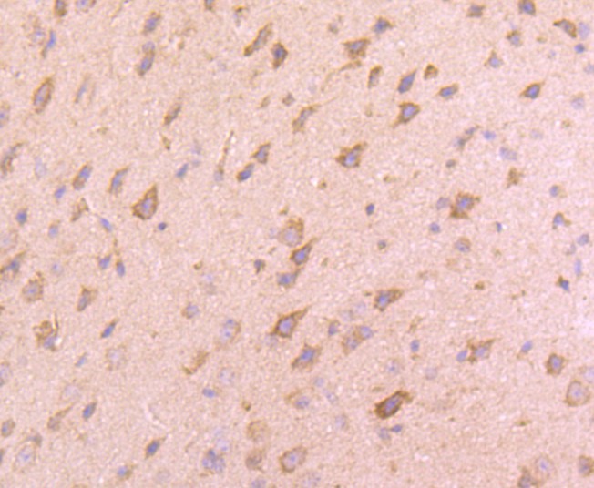 Immunohistochemical analysis of paraffin-embedded  mouse brain  tissue with Rabbit anti-VAMP8 antibody (ET1702-10) at 1/50 dilution.<br />
<br />
The section was pre-treated using heat mediated antigen retrieval with Tris-EDTA buffer (pH 9.0) for 20 minutes. The tissues were blocked in 1% BSA for 20 minutes at room temperature, washed with ddH2O and PBS, and then probed with the primary antibody (ET1702-10) at 1/400 dilution for 1 hour at room temperature. The detection was performed using an HRP conjugated compact polymer system. DAB was used as the chromogen. Tissues were counterstained with hematoxylin and mounted with DPX.
