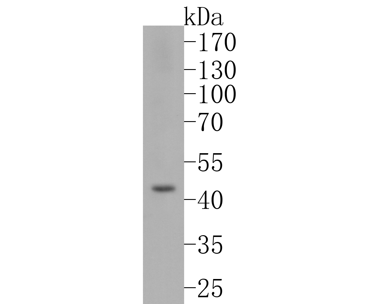 Western blot analysis of FOXP3 on K562 cell lysates. Proteins were transferred to a PVDF membrane and blocked with 5% BSA in PBS for 1 hour at room temperature. The primary antibody (ET1702-12, 1/500) was used in 5% BSA at room temperature for 2 hours. Goat Anti-Rabbit IgG - HRP Secondary Antibody (HA1001) at 1:200,000 dilution was used for 1 hour at room temperature.