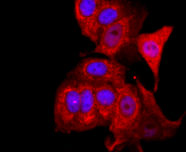 ICC staining of FOXP3 in MCF-7 cells (red). Formalin fixed cells were permeabilized with 0.1% Triton X-100 in TBS for 10 minutes at room temperature and blocked with 10% negative goat serum for 15 minutes at room temperature. Cells were probed with the primary antibody (ET1702-12, 1/50) for 1 hour at room temperature, washed with PBS. Alexa Fluor®594 conjugate-Goat anti-Rabbit IgG was used as the secondary antibody at 1/1,000 dilution. The nuclear counter stain is DAPI (blue).
