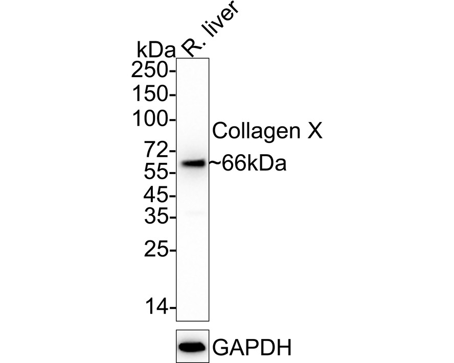 Western blot analysis of Collagen X on rat liver tissue lysates. Proteins were transferred to a PVDF membrane and blocked with 5% BSA in PBS for 1 hour at room temperature. The primary antibody (ET1702-13, 1/500) was used in 5% BSA at room temperature for 2 hours. Goat Anti-Rabbit IgG - HRP Secondary Antibody (HA1001) at 1:5,000 dilution was used for 1 hour at room temperature.