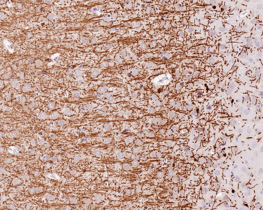 Immunohistochemical analysis of paraffin-embedded rat brain tissue with Rabbit anti-Myelin Basic Protein antibody (ET1702-15) at 1/1,000 dilution.<br />
<br />
The section was pre-treated using heat mediated antigen retrieval with Tris-EDTA buffer (pH 9.0) for 20 minutes. The tissues were blocked in 1% BSA for 20 minutes at room temperature, washed with ddH2O and PBS, and then probed with the primary antibody (ET1702-15) at 1/1,000 dilution for 1 hour at room temperature. The detection was performed using an HRP conjugated compact polymer system. DAB was used as the chromogen. Tissues were counterstained with hematoxylin and mounted with DPX.