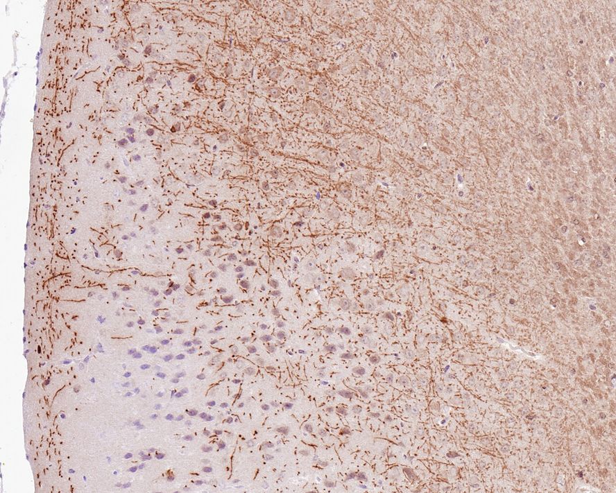 Immunohistochemical analysis of paraffin-embedded mouse brain tissue with Rabbit anti-Myelin Basic Protein antibody (ET1702-15) at 1/50 dilution.<br />
<br />
The section was pre-treated using heat mediated antigen retrieval with Tris-EDTA buffer (pH 9.0) for 20 minutes. The tissues were blocked in 1% BSA for 20 minutes at room temperature, washed with ddH2O and PBS, and then probed with the primary antibody (ET1702-15) at 1/400 dilution for 1 hour at room temperature. The detection was performed using an HRP conjugated compact polymer system. DAB was used as the chromogen. Tissues were counterstained with hematoxylin and mounted with DPX.