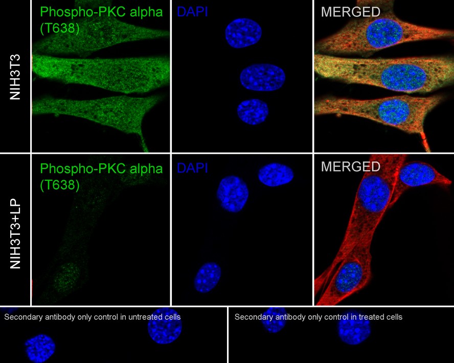 ICC staining of Phospho-PKC alpha (T638) in MCF-7 cells (green). Formalin fixed cells were permeabilized with 0.1% Triton X-100 in TBS for 10 minutes at room temperature and blocked with 1% Blocker BSA for 15 minutes at room temperature. Cells were probed with the primary antibody (ET1702-17, 1/50) for 1 hour at room temperature, washed with PBS. Alexa Fluor®488 Goat anti-Rabbit IgG was used as the secondary antibody at 1/1,000 dilution. The nuclear counter stain is DAPI (blue).