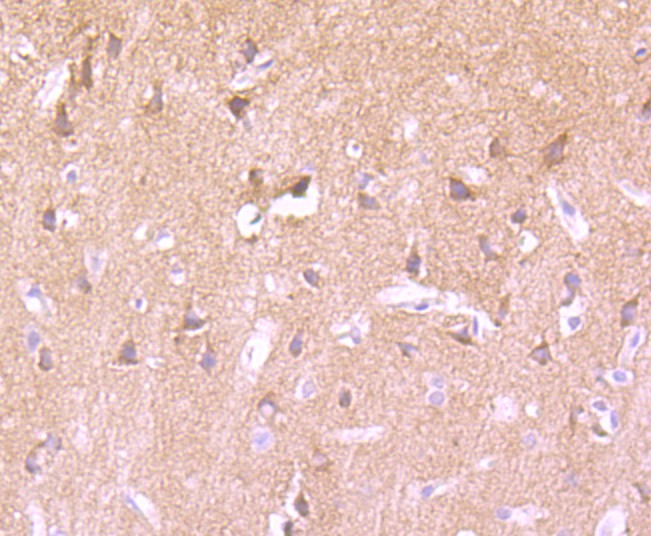 Immunohistochemical analysis of paraffin-embedded rat brain tissue using anti-Phospho-PKC alpha (T638) antibody. The section was pre-treated using heat mediated antigen retrieval with Tris-EDTA buffer (pH 8.0-8.4) for 20 minutes.The tissues were blocked in 5% BSA for 30 minutes at room temperature, washed with ddH2O and PBS, and then probed with the primary antibody (ET1702-17, 1/50) for 30 minutes at room temperature. The detection was performed using an HRP conjugated compact polymer system. DAB was used as the chromogen. Tissues were counterstained with hematoxylin and mounted with DPX.