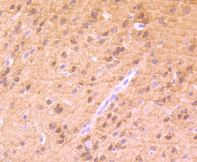 Immunohistochemical analysis of paraffin-embedded mouse brain tissue using anti-Phospho-PKC alpha (T638) antibody. The section was pre-treated using heat mediated antigen retrieval with Tris-EDTA buffer (pH 8.0-8.4) for 20 minutes.The tissues were blocked in 5% BSA for 30 minutes at room temperature, washed with ddH2O and PBS, and then probed with the primary antibody (ET1702-17, 1/50) for 30 minutes at room temperature. The detection was performed using an HRP conjugated compact polymer system. DAB was used as the chromogen. Tissues were counterstained with hematoxylin and mounted with DPX.