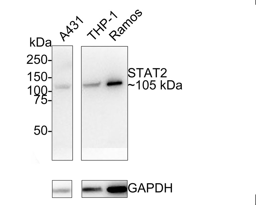 Western blot analysis of STAT2 on different lysates with Rabbit anti-STAT2 antibody (ET1702-18) at 1/500 dilution.<br />
<br />
Lane 1: Hela cell lysate<br />
Lane 2: K562 cell lysate<br />
<br />
Lysates/proteins at 10 µg/Lane.<br />
<br />
Predicted band size: 98 kDa<br />
Observed band size: 105 kDa<br />
<br />
Exposure time: 2 minutes;<br />
<br />
8% SDS-PAGE gel.<br />
<br />
Proteins were transferred to a PVDF membrane and blocked with 5% NFDM/TBST for 1 hour at room temperature. The primary antibody (ET1702-18) at 1/500 dilution was used in 5% NFDM/TBST at room temperature for 2 hours. Goat Anti-Rabbit IgG - HRP Secondary Antibody (HA1001) at 1:300,000 dilution was used for 1 hour at room temperature.
