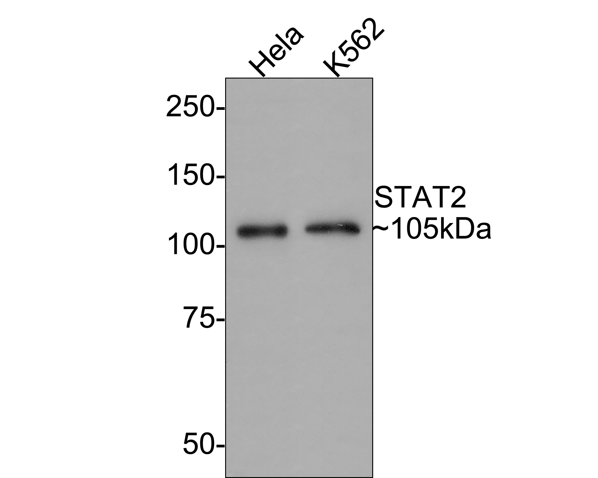 Western blot analysis of STAT2 on A431 cell lysates with Rabbit anti-STAT2 antibody (ET1702-18) at 1/500 dilution.<br />
<br />
Lysates/proteins at 10 µg/Lane.<br />
<br />
Predicted band size: 98 kDa<br />
Observed band size: 105 kDa<br />
<br />
Exposure time: 1 minute;<br />
<br />
6% SDS-PAGE gel.<br />
<br />
Proteins were transferred to a PVDF membrane and blocked with 5% NFDM/TBST for 1 hour at room temperature. The primary antibody (ET1702-18) at 1/500 dilution was used in 5% NFDM/TBST at room temperature for 2 hours. Goat Anti-Rabbit IgG - HRP Secondary Antibody (HA1001) at 1:300,000 dilution was used for 1 hour at room temperature.