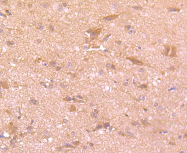Immunohistochemical analysis of paraffin-embedded rat brain tissue using anti-Tissue type plasminogen activator antibody. The section was pre-treated using heat mediated antigen retrieval with Tris-EDTA buffer (pH 9.0) for 20 minutes.The tissues were blocked in 1% BSA for 30 minutes at room temperature, washed with ddH2O and PBS, and then probed with the primary antibody (ET1702-19, 1/50) for 30 minutes at room temperature. The detection was performed using an HRP conjugated compact polymer system. DAB was used as the chromogen. Tissues were counterstained with hematoxylin and mounted with DPX.