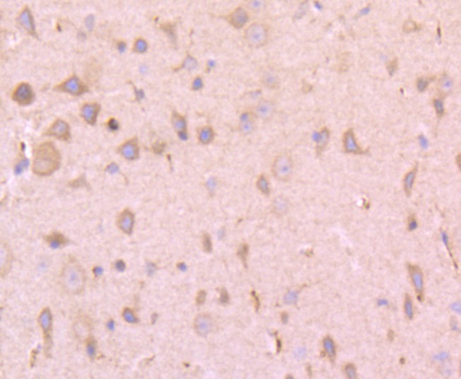 Immunohistochemical analysis of paraffin-embedded mouse brain tissue using anti-Tissue type plasminogen activator antibody. The section was pre-treated using heat mediated antigen retrieval with Tris-EDTA buffer (pH 9.0) for 20 minutes.The tissues were blocked in 1% BSA for 30 minutes at room temperature, washed with ddH2O and PBS, and then probed with the primary antibody (ET1702-19, 1/50) for 30 minutes at room temperature. The detection was performed using an HRP conjugated compact polymer system. DAB was used as the chromogen. Tissues were counterstained with hematoxylin and mounted with DPX.