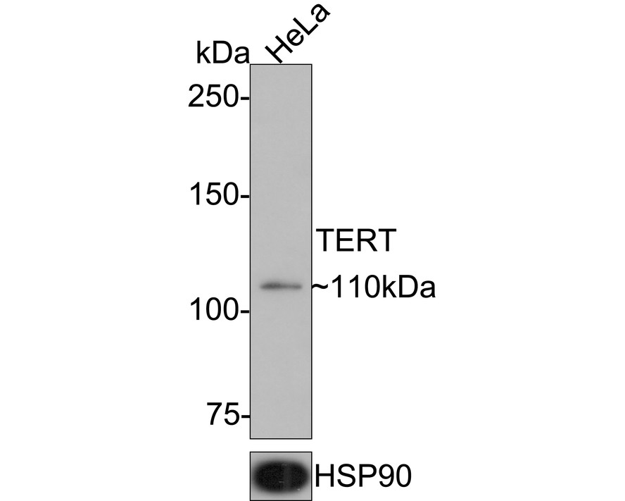 Western blot analysis of Telomerase reverse transcriptase on HeLa cell lysates with Rabbit anti-Telomerase reverse transcriptase antibody (ET1702-22) at 1/500 dilution.<br />
<br />
Lysates/proteins at 10 µg/Lane.<br />
<br />
Predicted band size: 110 kDa<br />
Observed band size: 110 kDa<br />
<br />
Exposure time: 2 minutes;<br />
<br />
6% SDS-PAGE gel.<br />
<br />
Proteins were transferred to a PVDF membrane and blocked with 5% NFDM/TBST for 1 hour at room temperature. The primary antibody (ET1702-22) at 1/500 dilution was used in 5% NFDM/TBST at room temperature for 2 hours. Goat Anti-Rabbit IgG - HRP Secondary Antibody (HA1001) at 1:100,000 dilution was used for 1 hour at room temperature.
