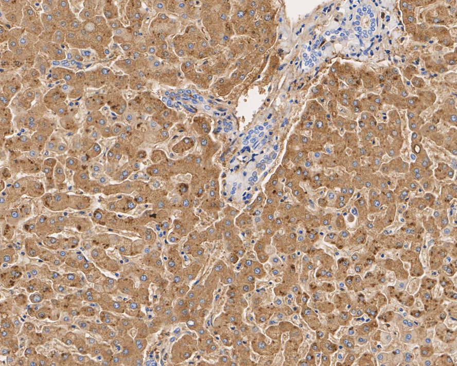 ICC staining of Apolipoprotein A1 in N2A cells (green). Formalin fixed cells were permeabilized with 0.1% Triton X-100 in TBS for 10 minutes at room temperature and blocked with 1% Blocker BSA for 15 minutes at room temperature. Cells were probed with the primary antibody (ET1702-23, 1/50) for 1 hour at room temperature, washed with PBS. Alexa Fluor®488 Goat anti-Rabbit IgG was used as the secondary antibody at 1/1,000 dilution. The nuclear counter stain is DAPI (blue).