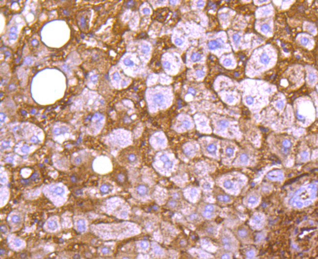 Immunohistochemical analysis of paraffin-embedded human liver tissue using anti-Apolipoprotein A1 antibody. The section was pre-treated using heat mediated antigen retrieval with Tris-EDTA buffer (pH 8.0-8.4) for 20 minutes.The tissues were blocked in 5% BSA for 30 minutes at room temperature, washed with ddH2O and PBS, and then probed with the primary antibody (ET1702-23, 1/200) for 30 minutes at room temperature. The detection was performed using an HRP conjugated compact polymer system. DAB was used as the chromogen. Tissues were counterstained with hematoxylin and mounted with DPX.