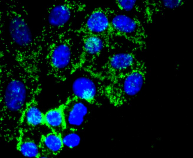 ICC staining of Fibronectin in NIH/3T3 cells (green). Formalin fixed cells were permeabilized with 0.1% Triton X-100 in TBS for 10 minutes at room temperature and blocked with 1% Blocker BSA for 15 minutes at room temperature. Cells were probed with the primary antibody (ET1702-25, 1/50) for 1 hour at room temperature, washed with PBS. Alexa Fluor®488 Goat anti-Rabbit IgG was used as the secondary antibody at 1/1,000 dilution. The nuclear counter stain is DAPI (blue).